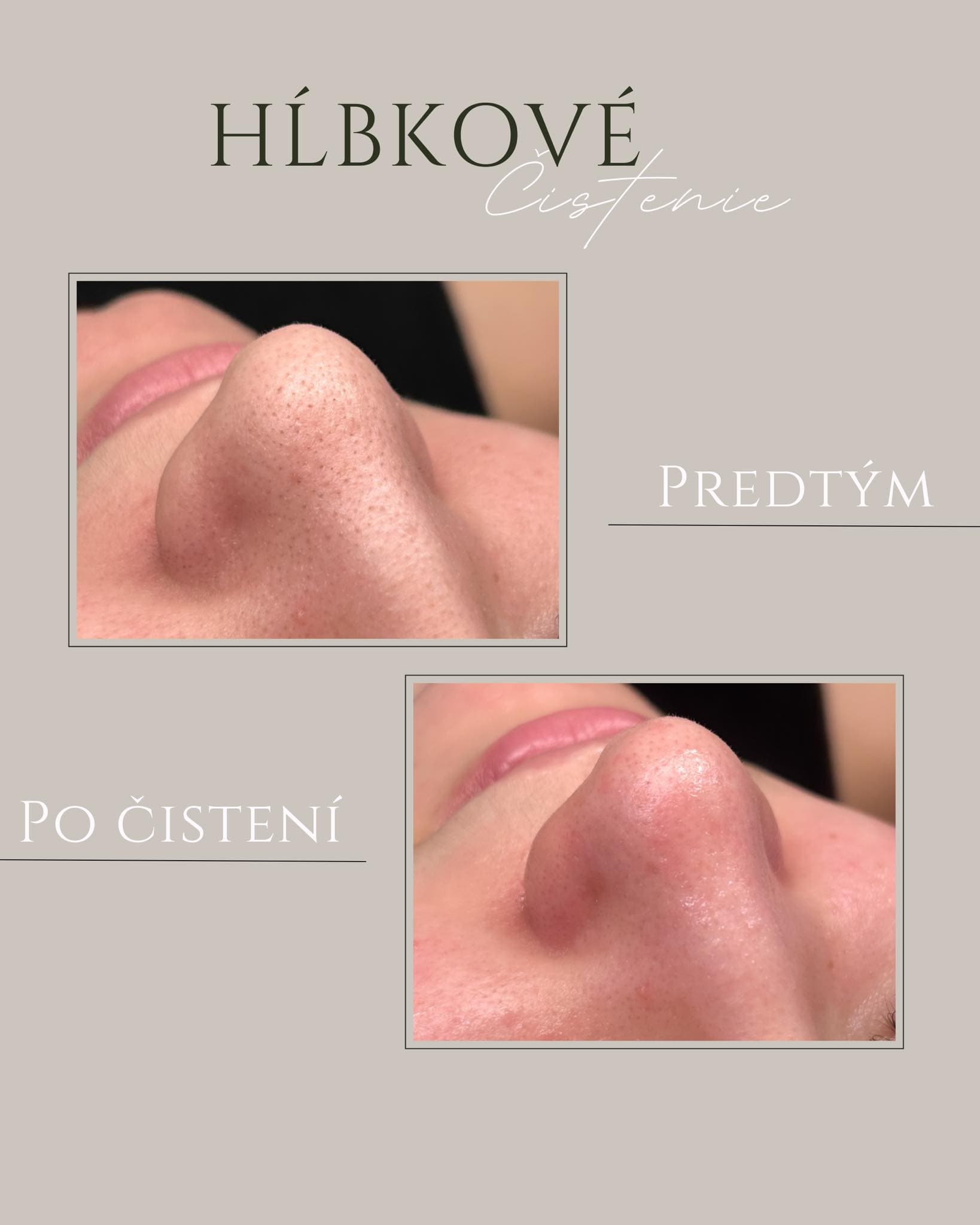 Amara Beauty Studio — ošetrenie