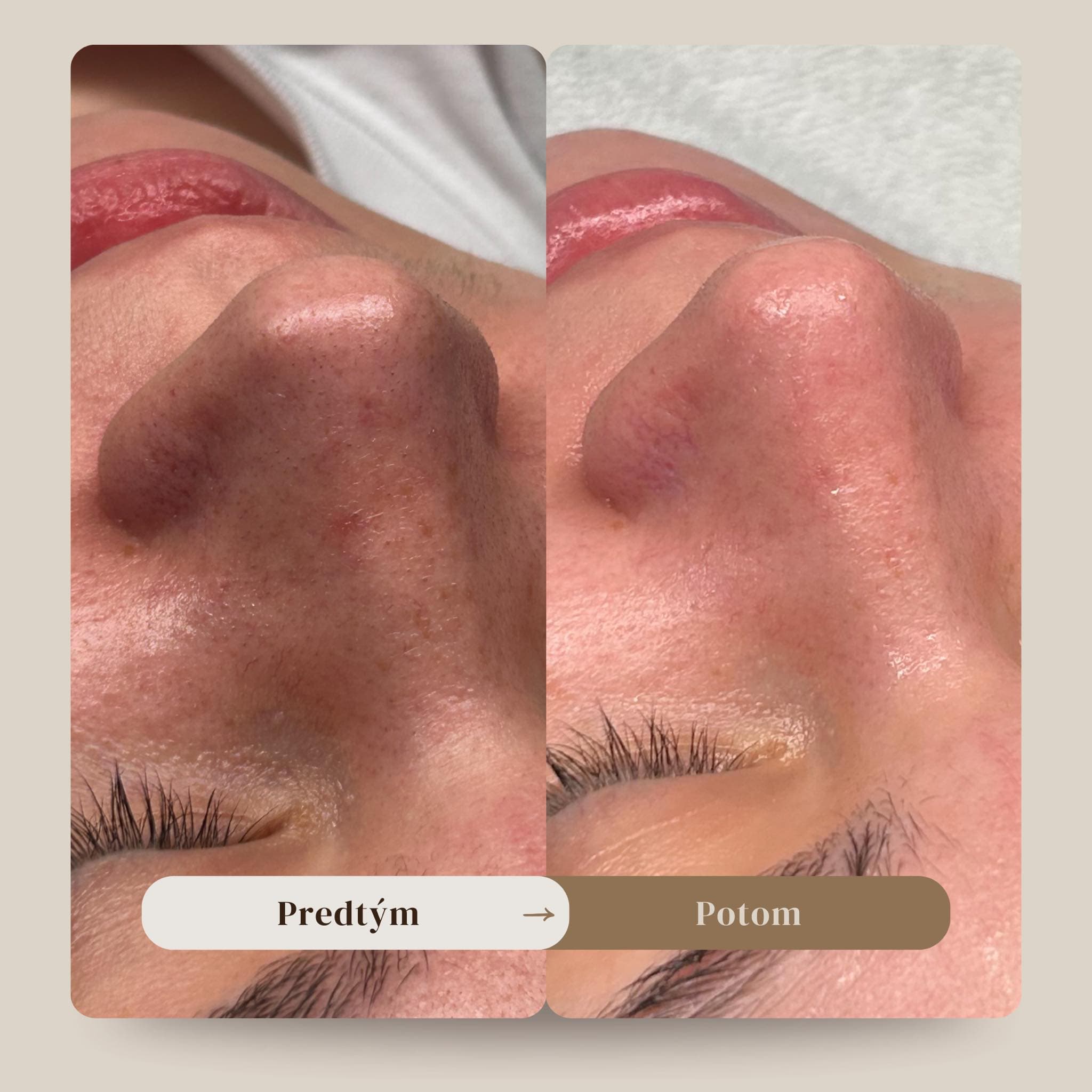 Amara Beauty Studio — ošetrenie